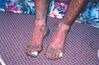 Filename=SoreFeet.jpg
Filesize=63KiB
Dimensions=600x395
Date added=Sep 16, 2018 SoreFeet.jpg